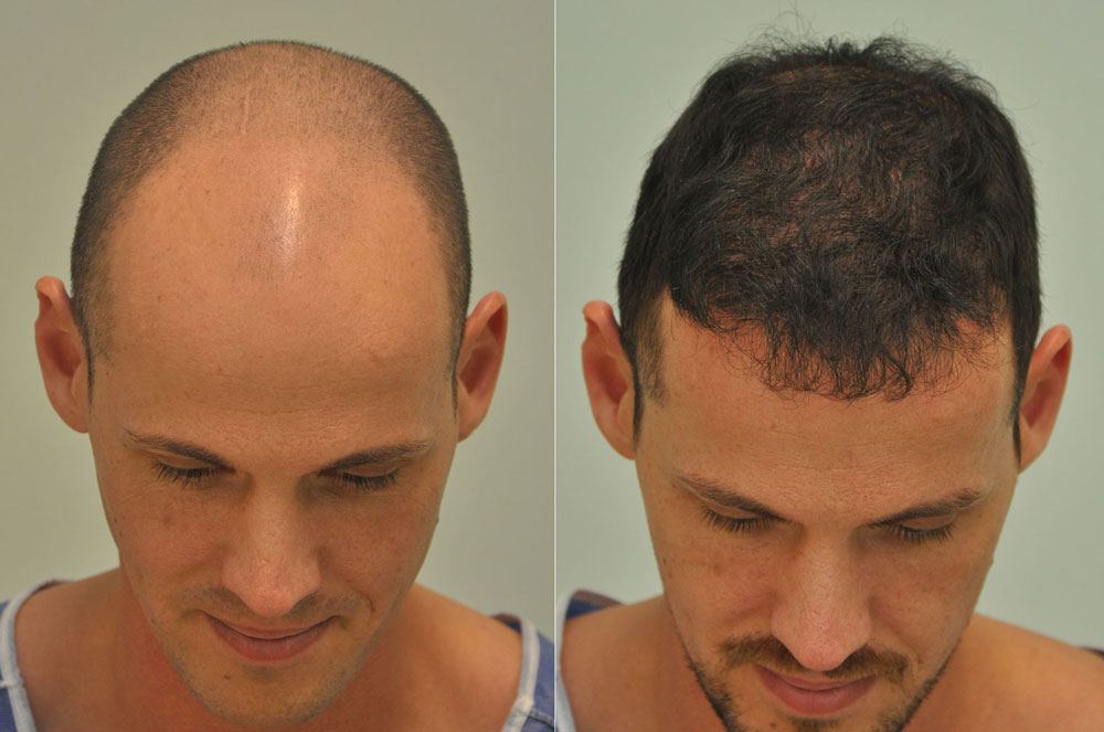 Dr. Sikos Hair Transplant Clinic and Plastic Surgery — Budapest, Hungary
