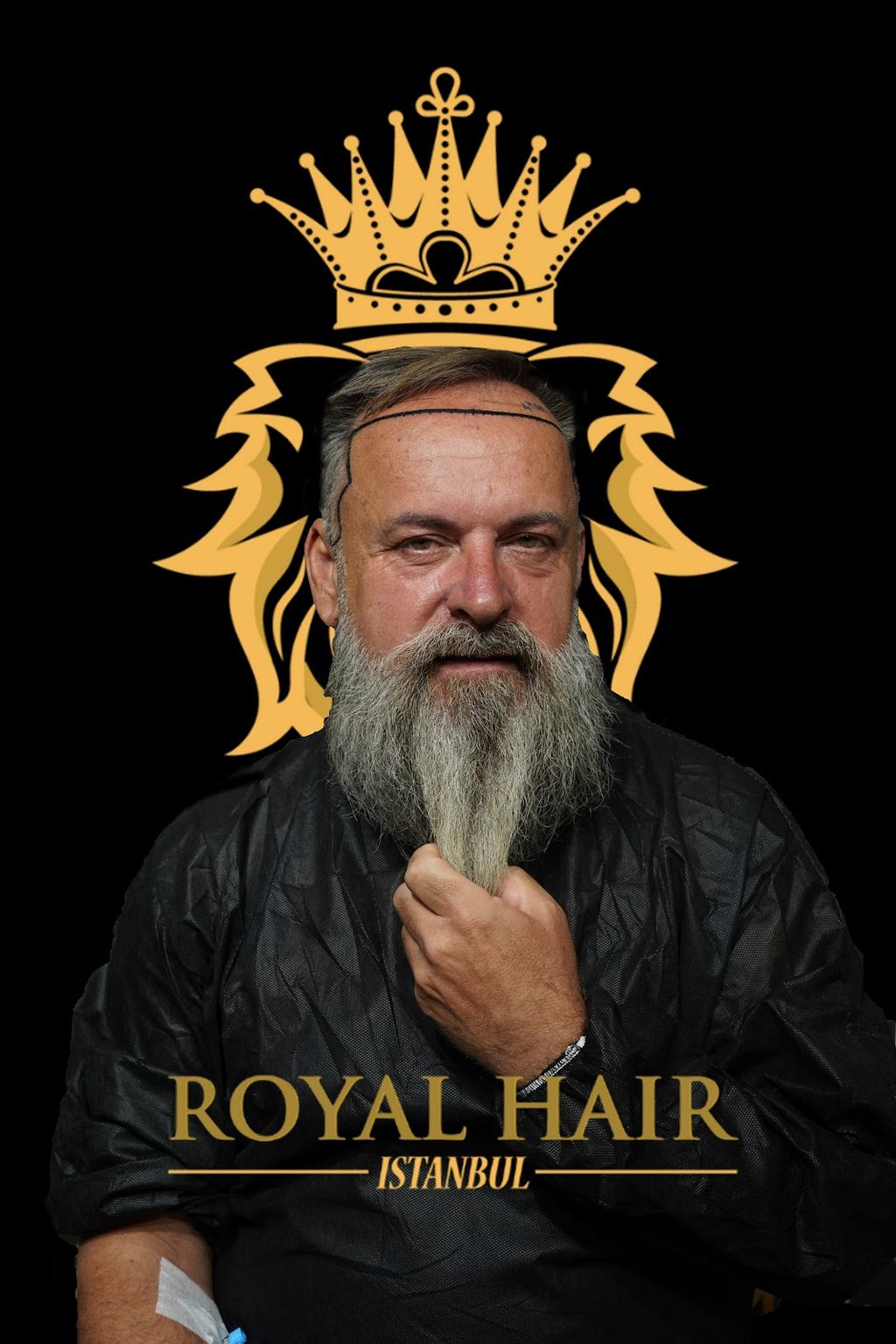 Royal Hair Istanbul | Hair Transplant Turkey — Istanbul, Turkey