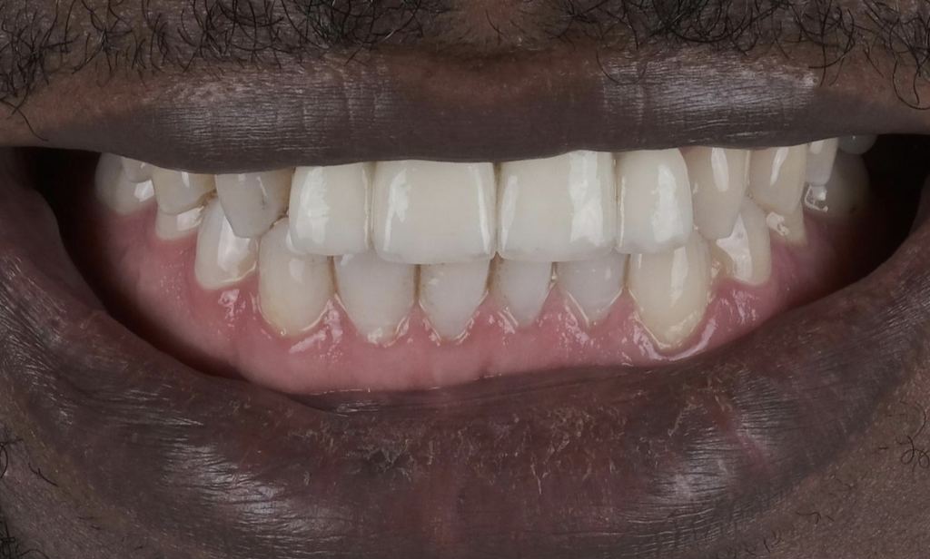 Prime Dental Turkey — Izmir, Turkey