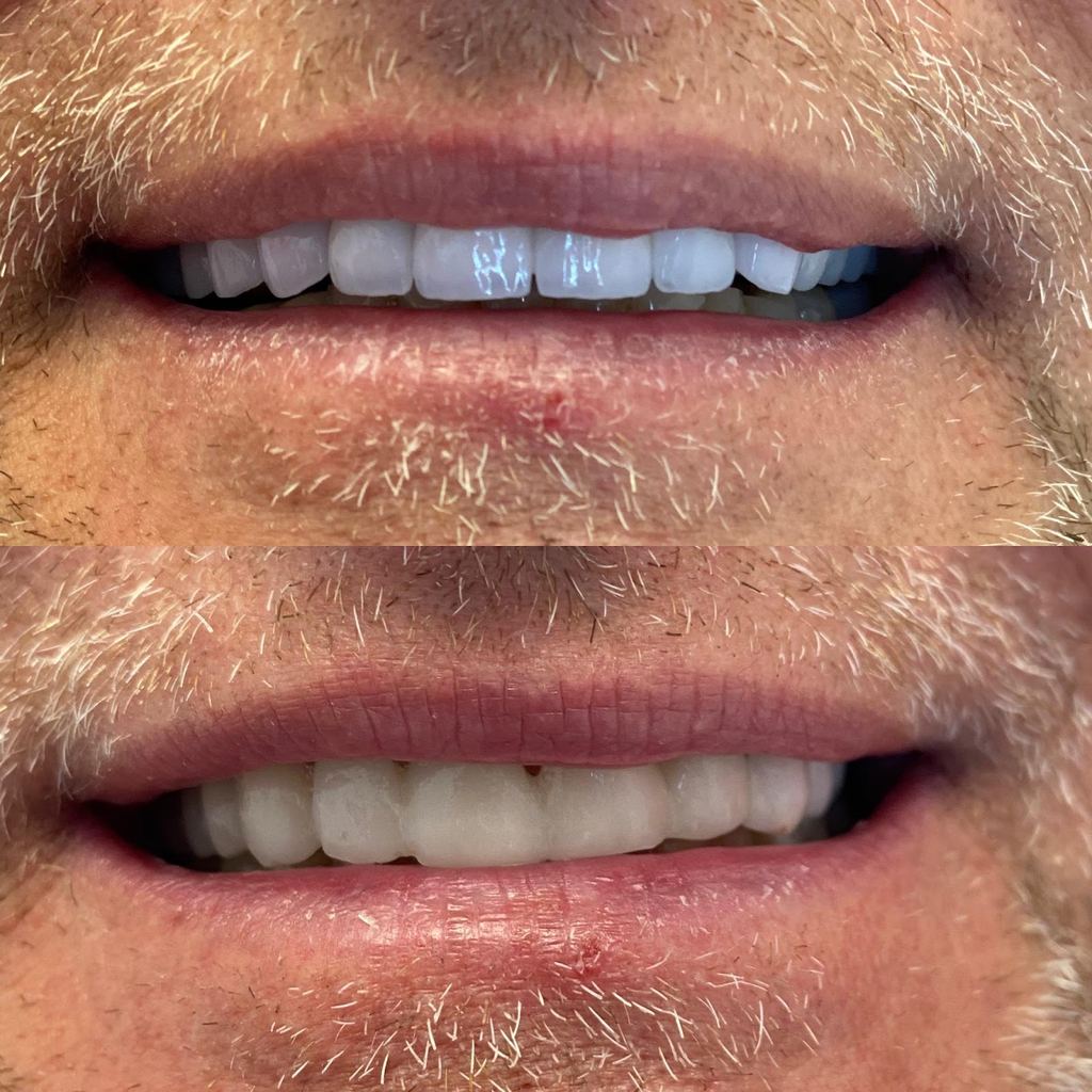 Crystal Dental — Budapest, Hungary