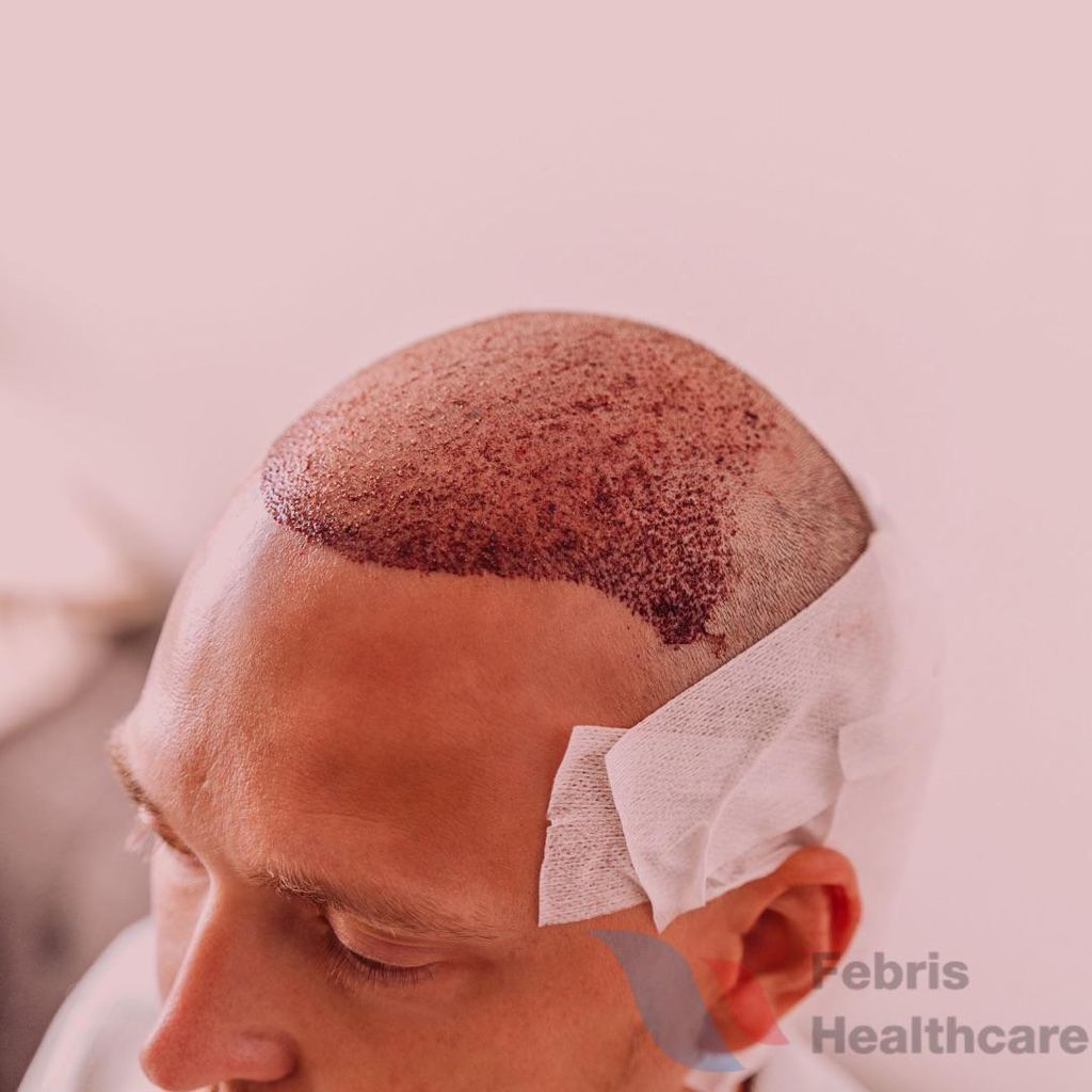 Wow Hair Clinic — Antalya, Turkey