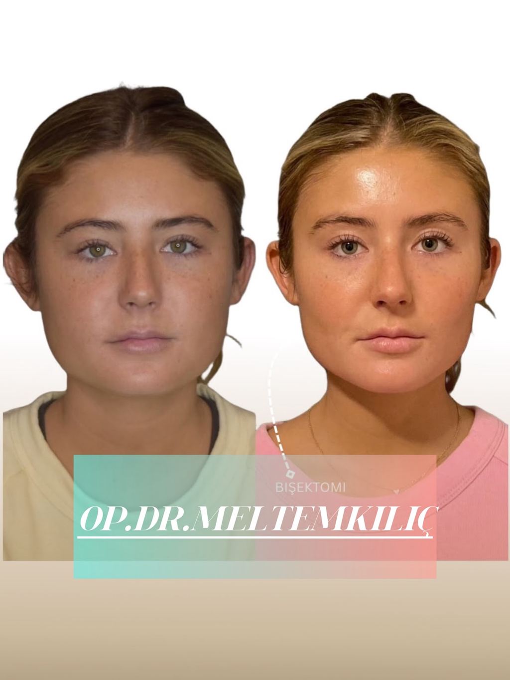 Op. Dr. Meltem Kılıç | İzmir Plastik, Rekonstrüktif ve Estetik Cerrahi | Aesthetics İzmir — Izmir, Turkey